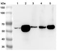 Western blot analysis was performed using anti-ATP6V1B2 polyclonal antibody at 1μg/ml on various samples.
Lane 1: 293T cell lysate
Lane 2: Mouse kidney lysate
Lane 3: Mouse brain lysate
Lane 4: Rat kidney lysate
Lane 5: Rat brain lysate