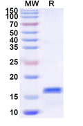Recombinant Human KLRK1 Protein, N-His