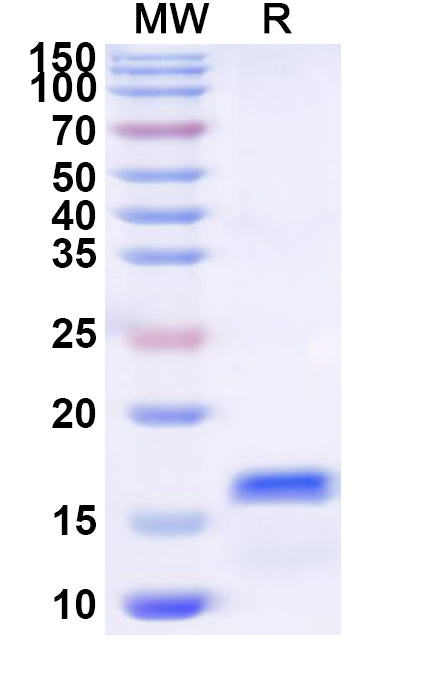 Recombinant Human KLRK1 Protein, N-His