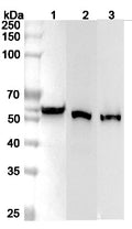 Western blot analysis was performed using anti-ALDH3A1 polyclonal antibody at 1μg/ml on various samples.
Lane 1: A549 cell lysate
Lane 2: Mouse eye lysate
Lane 3: Rat eye lysate