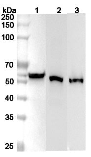 Western blot analysis was performed using anti-ALDH3A1 polyclonal antibody at 1μg/ml on various samples.
Lane 1: A549 cell lysate
Lane 2: Mouse eye lysate
Lane 3: Rat eye lysate