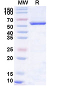 Recombinant Human Monoamine Oxidase B/MAOB/AOFB protein, N-His