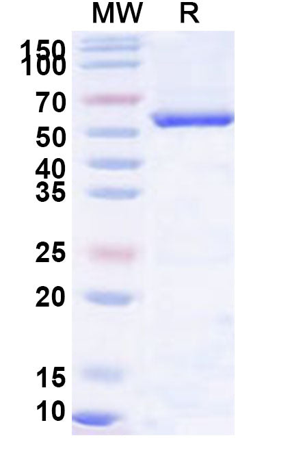 Recombinant Human Monoamine Oxidase B/MAOB/AOFB protein, N-His