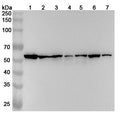 Western blot analysis was performed using anti-PDIA3 polyclonal antibody at 1ug/mL on various samples.
Lane 1: HepG2 cell lysate
Lane 2: A375 cell lysate
Lane 3: LO2 cell lysate
Lane 4: U2OS cell lysate
Lane 5: Lncap cell lysate
Lane 6: K562 cell lysate
Lane 7: Jurkat cell lysate