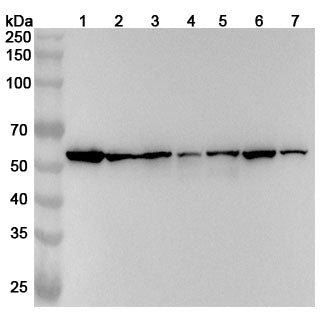 Western blot analysis was performed using anti-PDIA3 polyclonal antibody at 1ug/mL on various samples.
Lane 1: HepG2 cell lysate
Lane 2: A375 cell lysate
Lane 3: LO2 cell lysate
Lane 4: U2OS cell lysate
Lane 5: Lncap cell lysate
Lane 6: K562 cell lysate
Lane 7: Jurkat cell lysate