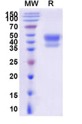 Recombinant Human CD75/ST6GAL1 Protein, C-His