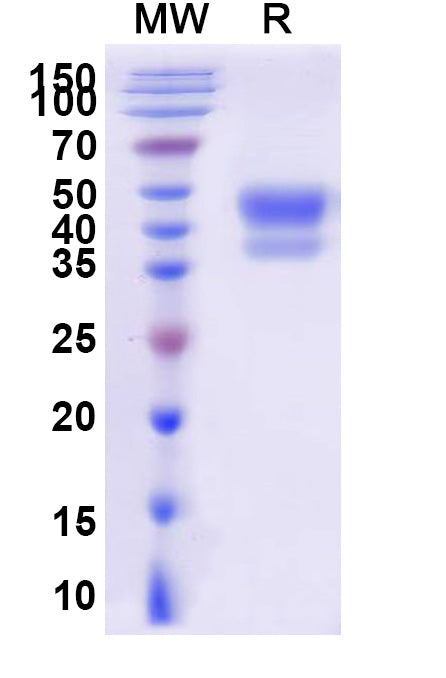 Recombinant Human CD75/ST6GAL1 Protein, C-His