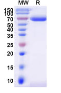 Recombinant Human ST6GAL1 Protein, C-Fc