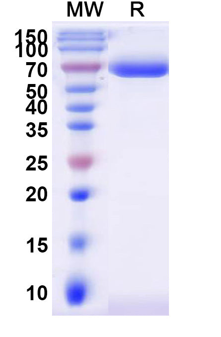 Recombinant Human ST6GAL1 Protein, C-Fc