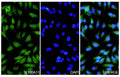 Hela cells were fixed with 4% paraformaldehyde for 20 minutes, followed by blocking with 5% goat serum for 1 hour. The cells were then incubated with a primary antibody targeting S100A11 (HB147014) at a concentration of 27 ug/ml overnight at 4°C. Afterward, the cells were incubated with a secondary antibody, Goat Anti-Rabbit IgG (Alexa Fluor-488) for 50 minutes at room temperature. The localization of S100A11 was visualized (shown in green), and nuclear DNA was stained with DAPI (shown in blue).