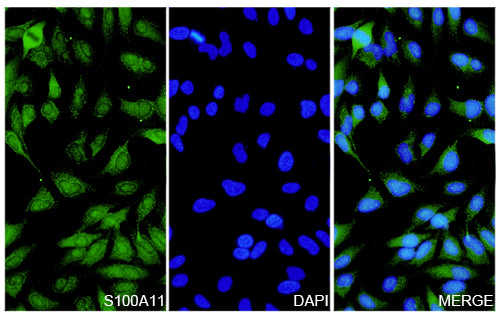 Hela cells were fixed with 4% paraformaldehyde for 20 minutes, followed by blocking with 5% goat serum for 1 hour. The cells were then incubated with a primary antibody targeting S100A11 (HB147014) at a concentration of 27 ug/ml overnight at 4°C. Afterward, the cells were incubated with a secondary antibody, Goat Anti-Rabbit IgG (Alexa Fluor-488) for 50 minutes at room temperature. The localization of S100A11 was visualized (shown in green), and nuclear DNA was stained with DAPI (shown in blue).