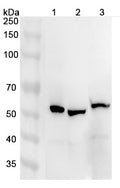Western blot analysis was performed using anti-ATP6V1B1 polyclonal antibody at 1μg/ml on various samples.
Lane 1: Mouse brain lysate
Lane 2: Mouse kidney lysate
Lane 3: Rat brain lysate