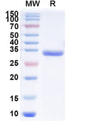 Recombinant Human EPOR Protein, C-His
