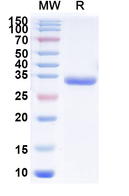 Recombinant Human EPOR Protein, C-His