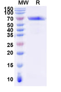 Recombinant Human EPOR Protein, C-Fc