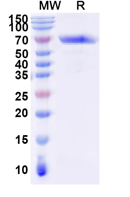 Recombinant Human EPOR Protein, C-Fc