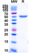 Recombinant Human CD49f/ITGA6 Protein, N-His