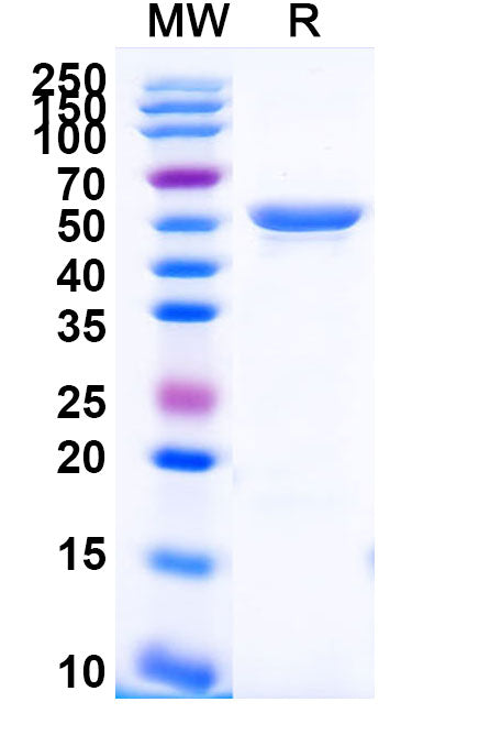 Recombinant Human CD49f/ITGA6 Protein, N-His