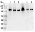 Western blot analysis was performed using anti-ITGA6 polyclonal antibody at 1ug/mL on various samples.
Lane 1: Mouse spleen lysate
Lane 2: Mouse lung lysate
Lane 3: Mouse skin lysate
Lane 4: Rat kidney lysate
Lane 5: Rat lung lysate
Lane 6: Rat skin lysate