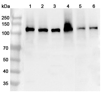 Western blot analysis was performed using anti-ITGA6 polyclonal antibody at 1ug/mL on various samples.
Lane 1: Mouse spleen lysate
Lane 2: Mouse lung lysate
Lane 3: Mouse skin lysate
Lane 4: Rat kidney lysate
Lane 5: Rat lung lysate
Lane 6: Rat skin lysate