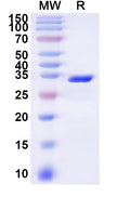 Recombinant Human SLC6A6 Protein, N-GST & C-His