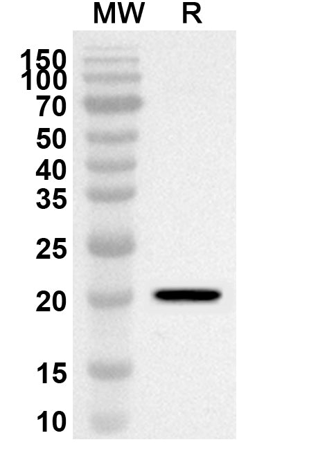 Western blot analysis was performed using anti-ATF6 polyclonal antibody at 1ug/mL on recombinant ATF6 (Catalog No. HB163032).
