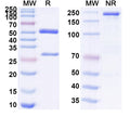 SDS-PAGE for Anti-Human LGALS3/Galectin-3 Antibody (SAA0313).