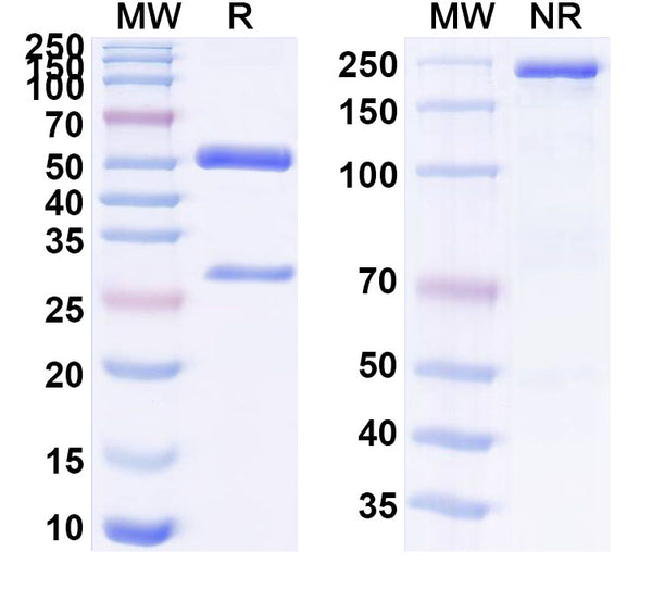 SDS-PAGE for Anti-Human LGALS3/Galectin-3 Antibody (SAA0313).