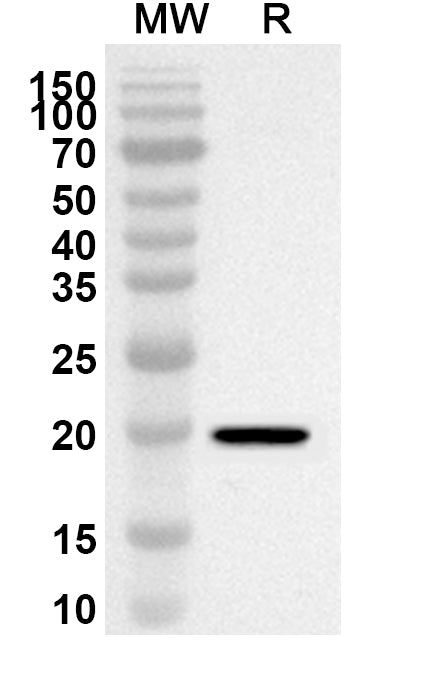 Western blot analysis was performed using anti-ATP5F1D polyclonal antibody at 1ug/mL on recombinant ATP5F1D (Catalog No. HB169012).