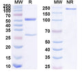 SDS-PAGE for Anti-Human FABP4/aP2 Antibody (SAA1478)