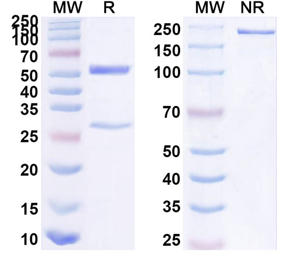 SDS-PAGE for Anti-Human FABP4/aP2 Antibody (SAA1478)