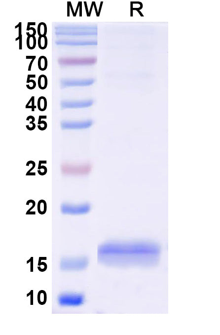 SDS-PAGE for Anti-Human CD33 Nanobody (SAA2052)