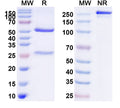 SDS-PAGE for Anti-Human CD159a/KLRC1 Antibody (Z270)