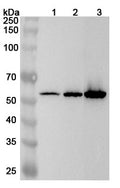 Western blot analysis was performed using anti-CALR polyclonal antibody at 1ug/mL on various samples.
Lane 1: SH-SY5Y cell lysate
Lane 2: Hela cell lysate
Lane 3: HL-60 cell lysate