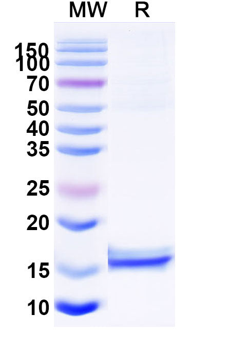 SDS-PAGE for Anti-Human CD72 Nanobody (NbD4)