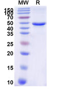 Recombinant Human TYR/Tyrosinase Protein, N-His