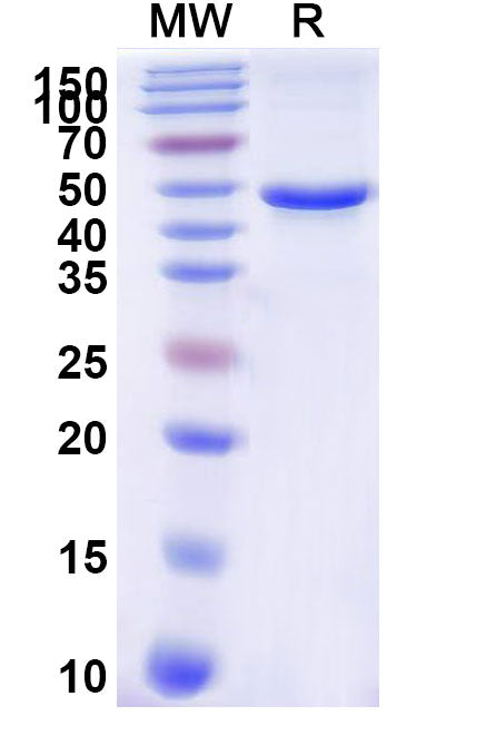 Recombinant Human TYR/Tyrosinase Protein, N-His