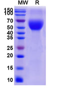 Recombinant Human CD66b/CEACAM8 Protein, C-His