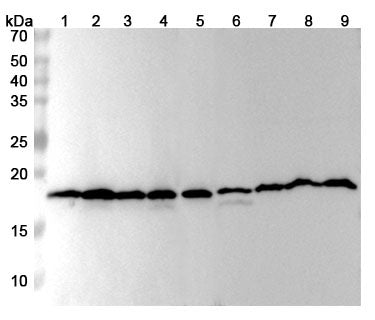 Western blot analysis was performed using anti-CFL1 polyclonal antibody at 1ug/mL  on various samples.
Lane 1: NIH3T3 cell lysate
Lane 2: MCF-7 cell  lysate
Lane 3: H1299 cell lysate
Lane 4: Hela cell lysate
Lane 5: Jurkat cell lysate
Lane 6: SH-SY5Y cell lysate
Lane 7: PC-12 cell lysate
Lane 8: Mouse brain lysate
Lane 9: Rat brain lysate
