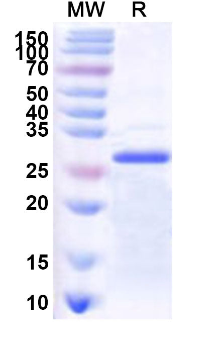 Recombinant Human OXTR Protein, N-His-KSI