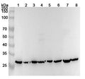Western blot analysis was performed using anti-ECHS1 polyclonal antibody at 1ug/mL on various samples.
Lane 1: Caco2 cell lysate
Lane 2: HepG2 cell lysate
Lane 3: MCF-7 cell lysate
Lane 4: PC-3 cell lysate
Lane 5: 293T cell lysate
Lane 6: Mouse heart lysate
Lane 7: Rat liver lysate
Lane 8: Rat heart lysate