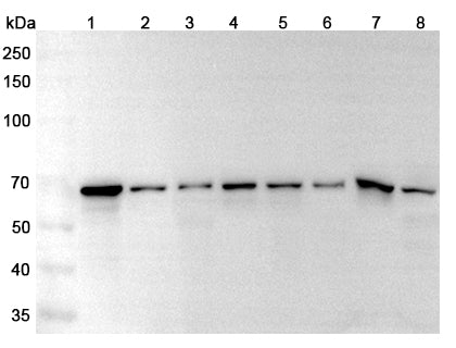 Western blot analysis was performed using anti-STIP1 polyclonal antibody at 1μg/ml on various samples.
Lane 1: BXPC3 cell lysate
Lane 2: SKOV3 cell lysate
Lane 3: Jurkat cell lysate
Lane 4: HepG2 cell lysate
Lane 5: Lncap cell lysate
Lane 6: Jurkat cell lysate
Lane 7: K562 cell lysate
Lane 8: NIH3T3 cell lysate