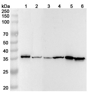 Western blot analysis was performed using anti-Cyclin D1 polyclonal antibody at 1ug/mL on various samples.
Lane 1: NIH3T3 cell lysate
Lane 2: HepG2 cell lysate
Lane 3: HCT116 cell lysate
Lane 4: PC-12 cell lysate
Lane 5: MCF-7 cell lysate
Lane 6: Lncap cell lysate