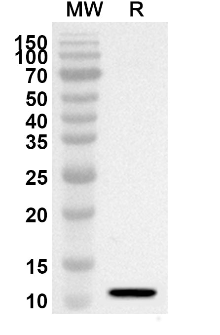 Western blot analysis was performed using anti-RAB5A polyclonal antibody at 1ug/mL on recombinant RAB5A (Catalog No. HB244012).