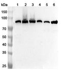Western blot analysis was performed using anti-MMUT polyclonal antibody at 1ug/mL on various samples.
Lane 1: Mouse heart lysate
Lane 2: Mouse kidney lysate
Lane 3: Mouse liver lysate
Lane 4: Rat heart lysate
Lane 5: Rat kidney lysate
Lane 6: Rat liver lysate
