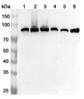 Western blot analysis was performed using anti-MMUT polyclonal antibody at 1ug/mL on various samples.
Lane 1: Mouse heart lysate
Lane 2: Mouse kidney lysate
Lane 3: Mouse liver lysate
Lane 4: Rat heart lysate
Lane 5: Rat kidney lysate
Lane 6: Rat liver lysate