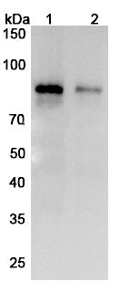 Anti-Human TGM2 Reference Antibody (Zampilimab) – Figure 1 of 3