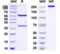 Anti-Human ITGB6 Reference Antibody (SGN-B6A) – Figure 1 of 1