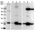 Western blot analysis was performed using anti-SDHB  polyclonal antibody at 1μg/ml on various samples.
Lane 1: K562 cell lysate
Lane 2: Mouse brain lysate
Lane 3: Mouse heart lysate
Lane 4: Mouse liver lysate
Lane 5: Rat brain lysate
Lane 6: Rat heart lysate
Lane 7: Rat liver lysate