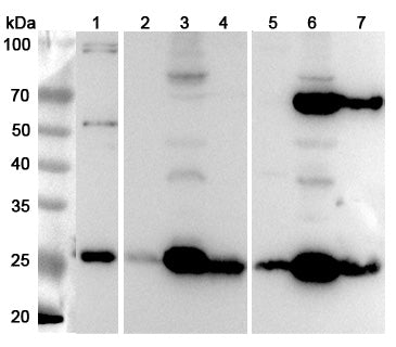 Western blot analysis was performed using anti-SDHB  polyclonal antibody at 1μg/ml on various samples.
Lane 1: K562 cell lysate
Lane 2: Mouse brain lysate
Lane 3: Mouse heart lysate
Lane 4: Mouse liver lysate
Lane 5: Rat brain lysate
Lane 6: Rat heart lysate
Lane 7: Rat liver lysate